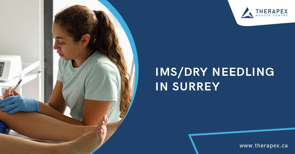 IMS Dry Needling in Surrey